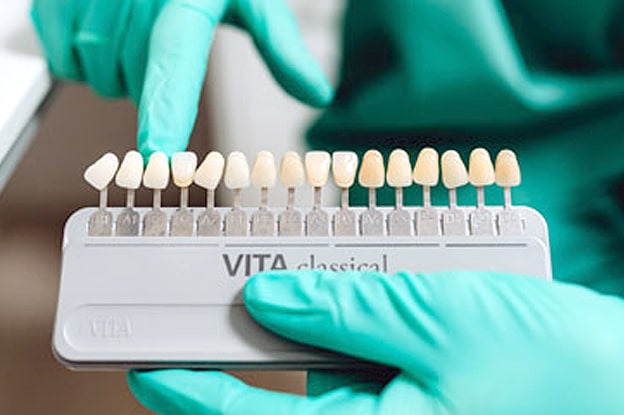 4 Ways Porcelain Veneers Can Improve Your Smile | Richmond, TX 4 Ways Porcelain Veneers Can Improve Your Smile | Richmond, TX