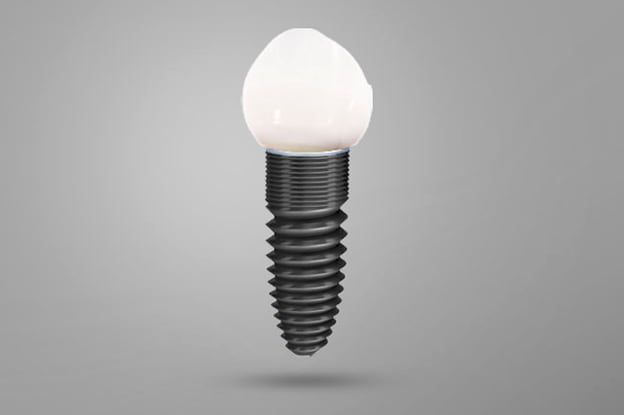 Dental Implants Procedure, Cost, Types, Problems & Safe | Richmond TX Dental Implants Procedure, Cost, Types, Problems & Safe | Richmond TX