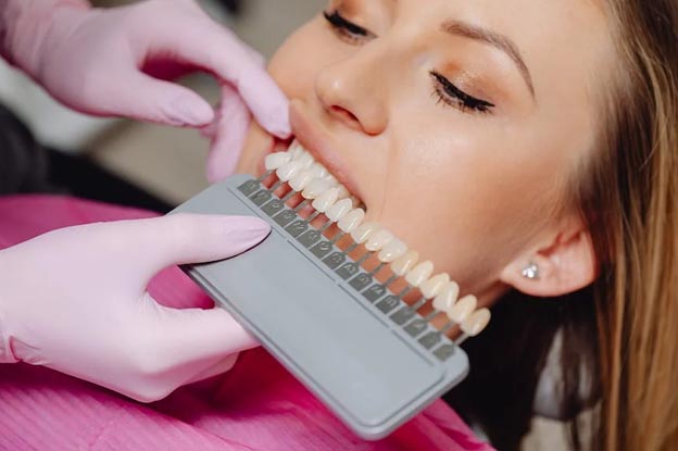 Dental Veneers: Types and Benefits Dental Veneers: Types and Benefits