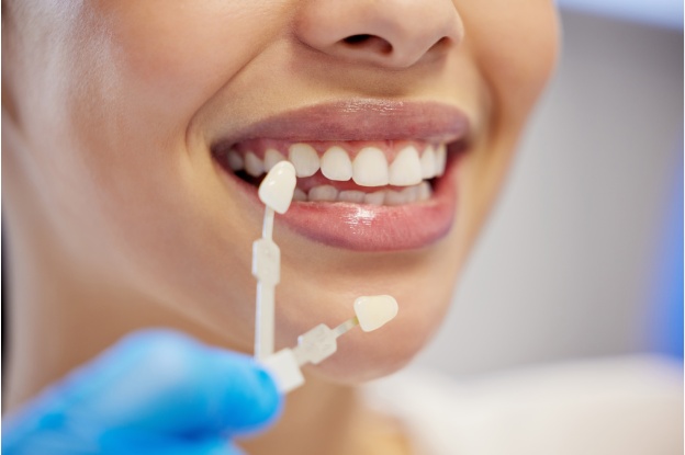 Essential Aftercare Tips for Porcelain Veneers in Katy Essential Aftercare Tips for Porcelain Veneers in Katy