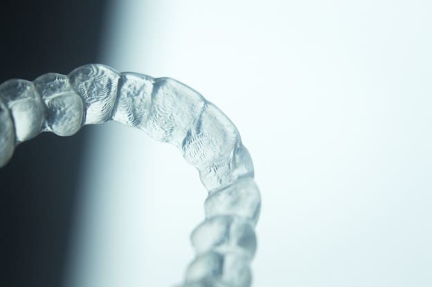 Trusting MTM Clear Aligners To Improve Your Smile Trusting MTM Clear Aligners To Improve Your Smile