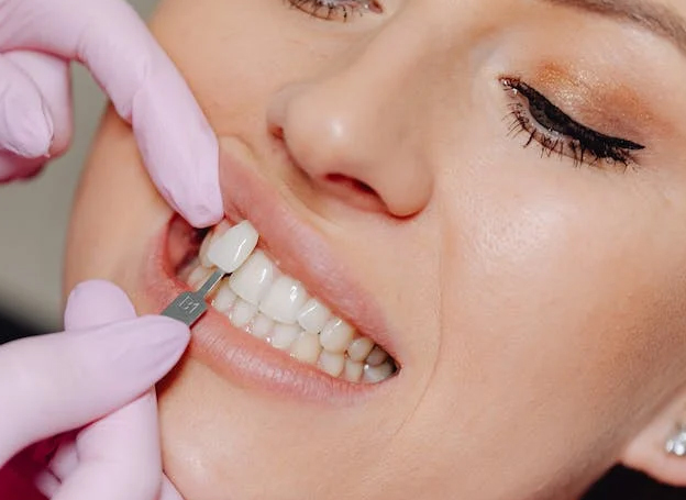 Smile Makeover: Veneers, Invisalign, & Teeth Whitening in Katy Smile Makeover: Veneers, Invisalign, & Teeth Whitening in Katy