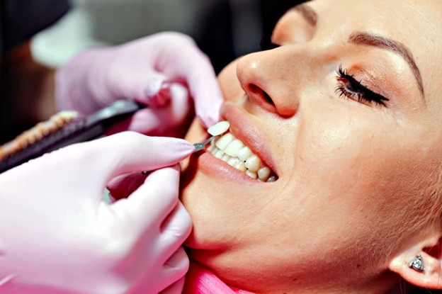 Patient receiving dental veneers in Rosenberg treatment, with a dentist using tools to carefully place and adjust veneers on her front teeth to enhance her smile.