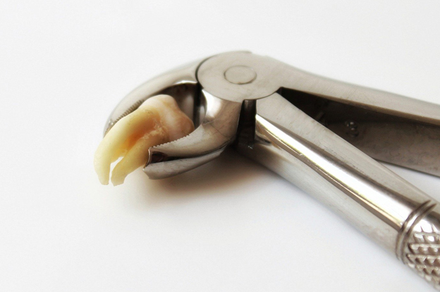 What Is Considered Emergency Dental Extraction? | Katy, TX What Is Considered Emergency Dental Extraction? | Katy, TX
