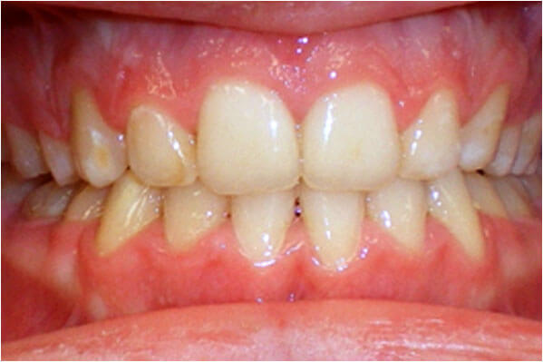 Orthodontics After