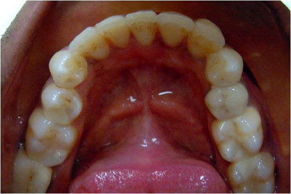 Orthodontics After